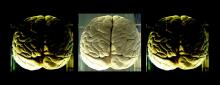 Como se ejercita el cerebro con el tenis